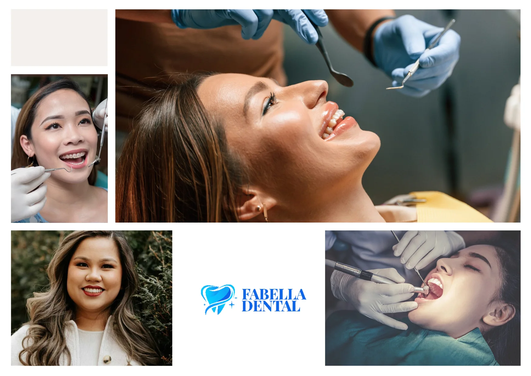 Fabella Dental – Expert Care for Healthy and Bright Smiles