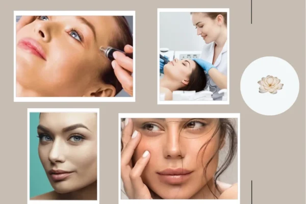 Experience Trusted Fractionated Laser Skin Resurfacing for Safe and Effective Skin Renewal at Lotus @ Queensway Medical