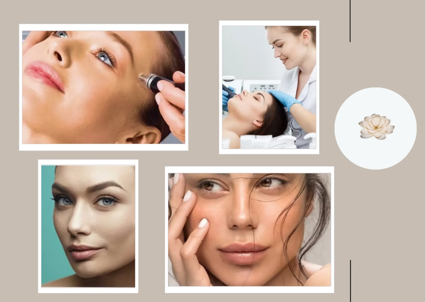 Experience Trusted Fractionated Laser Skin Resurfacing for Safe and Effective Skin Renewal at Lotus @ Queensway Medical